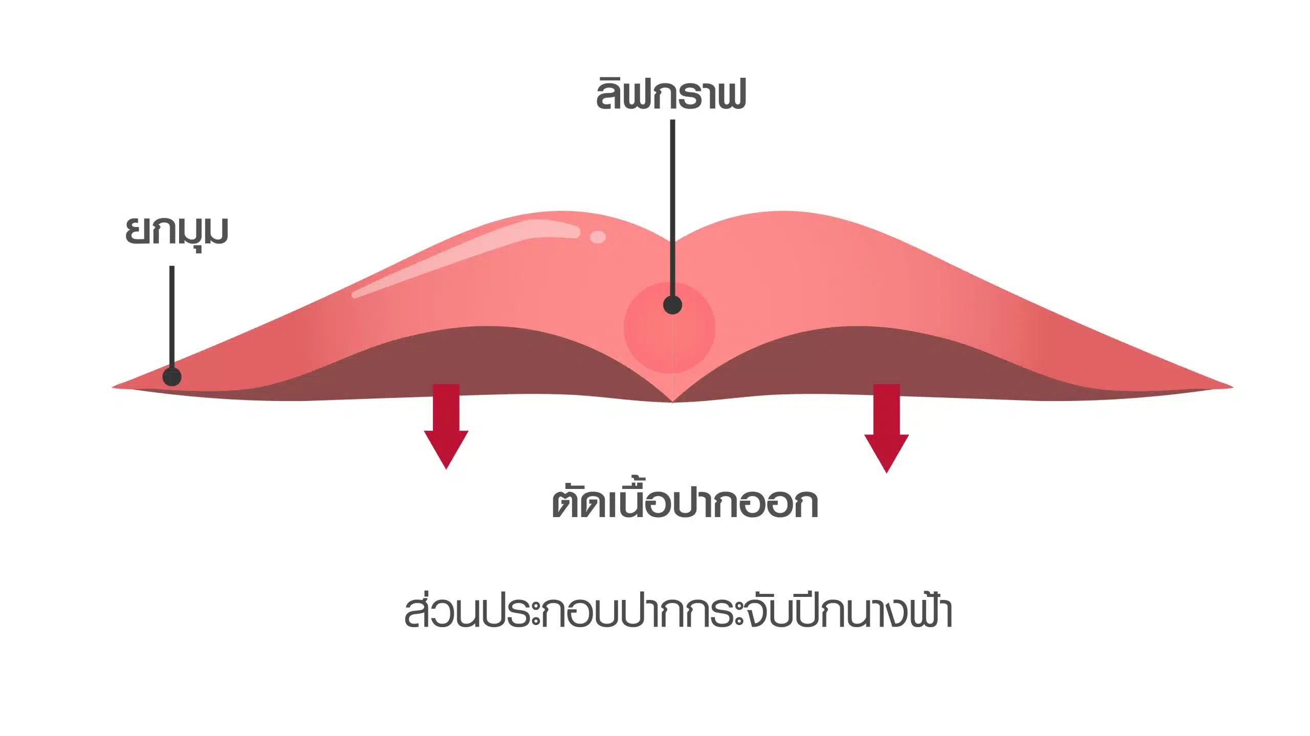 ลิฟกราฟคืออะไร