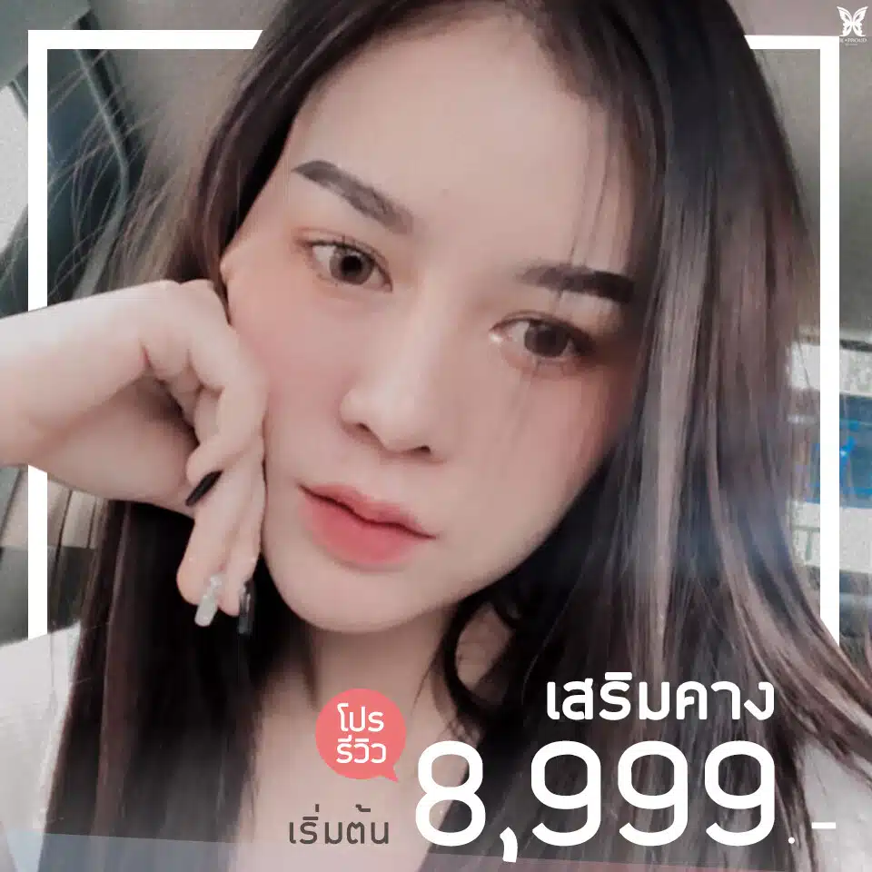 โปรเสริมคาง 8999