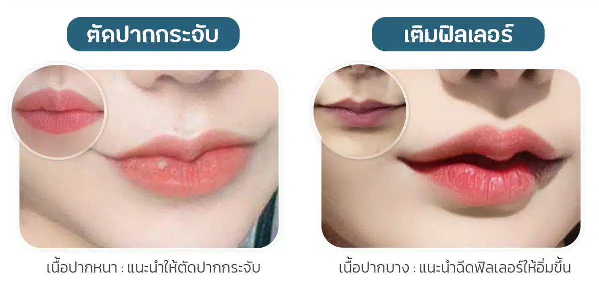 สาเหตุที่อยากทำปาก