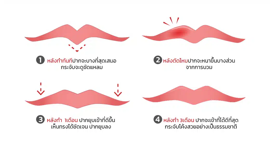 ระยะการคลายตัวของปาก