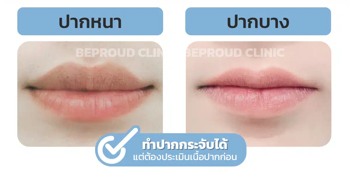 ปากบาง-ปากหนา ทำปากได้มั้ย