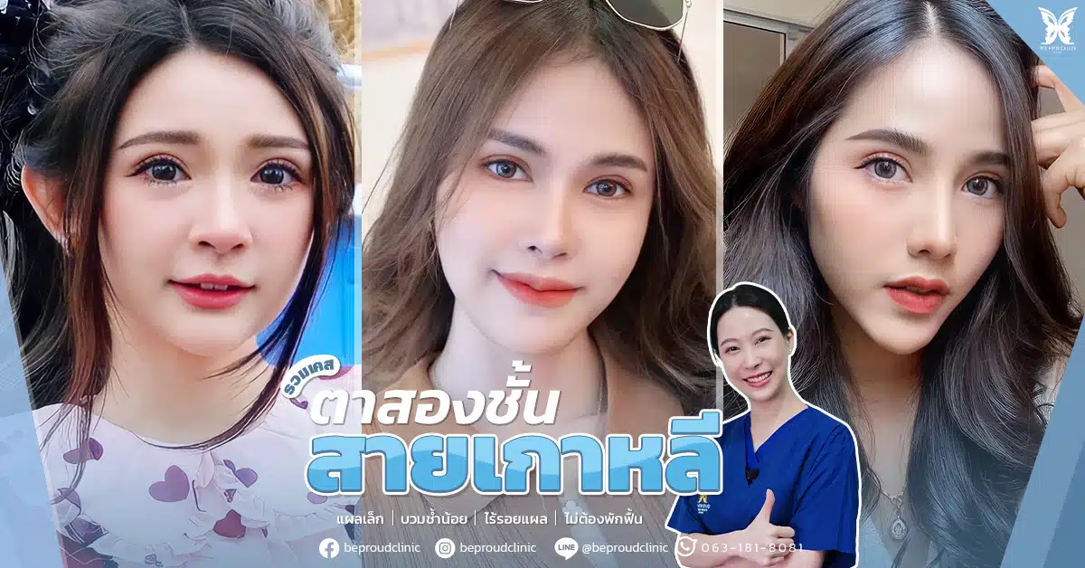 รวมตาสองชั้นสายเกา_บทความ_ปก