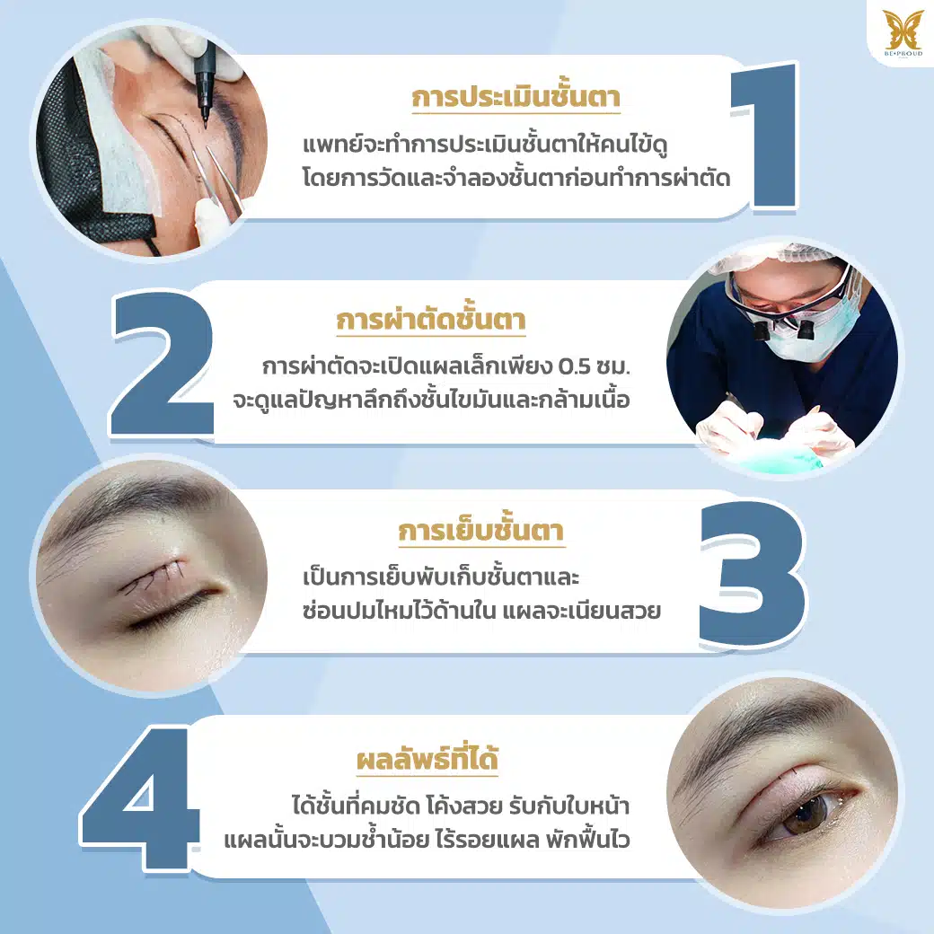 ขั้นตอนการทำตาสองชั้น