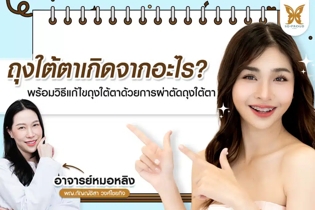 ถุงใต้ตาเกิดจากอะไร ถุงใต้ตา