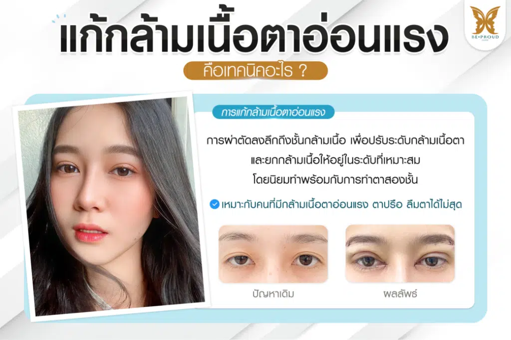 หมอดา ศัลยกรรมตกแต่งใบหน้า (Plastic Surgery)