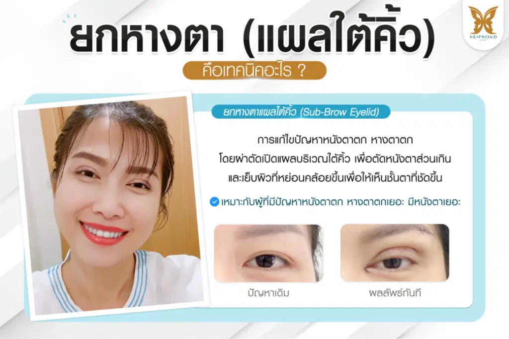 หมอดา ศัลยกรรมตกแต่งใบหน้า (Plastic Surgery)