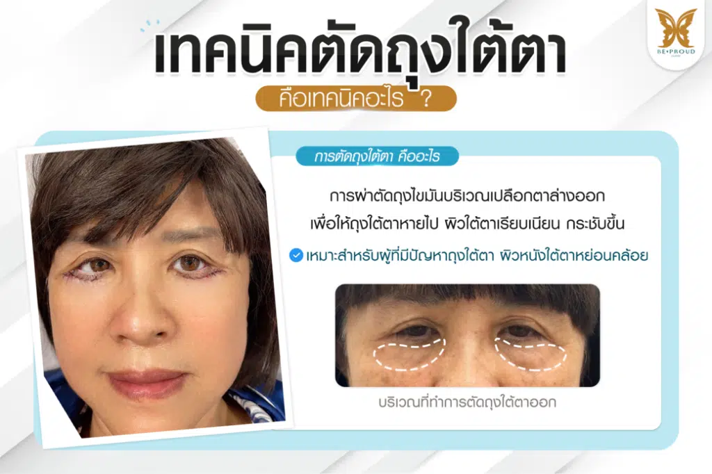 หมอดา ศัลยกรรมตกแต่งใบหน้า (Plastic Surgery)