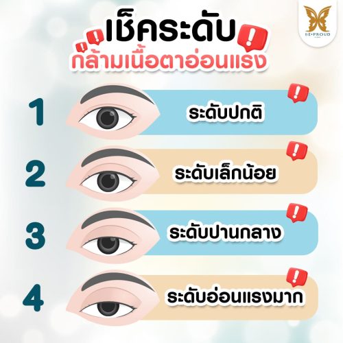 กล้ามเนื้อตาอ่อนแรง