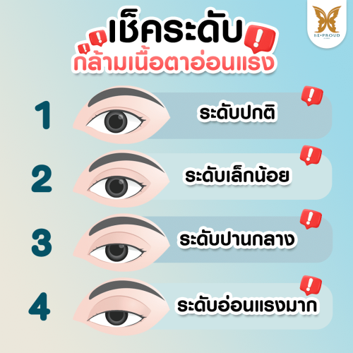 กล้ามเนื้อตาอ่อนแรง